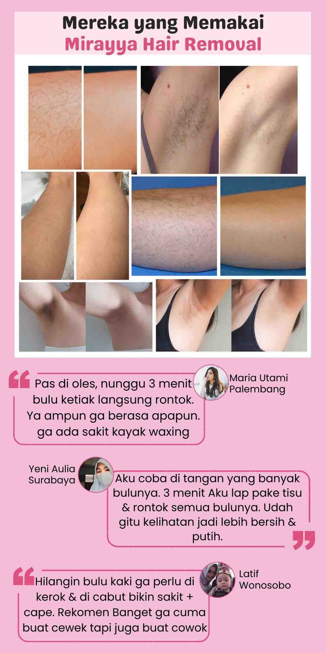 Mirayya hair removal 2 - 4